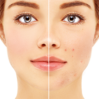 Skin-Pigmentation