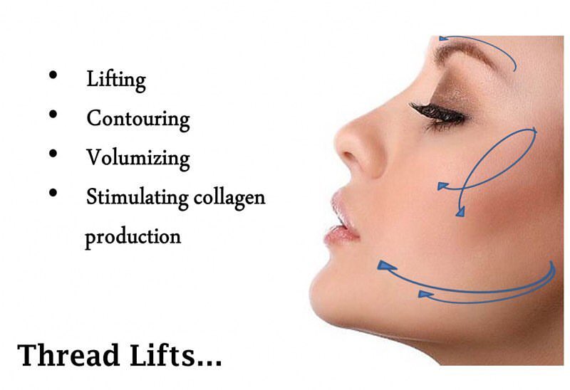 Thread Lifts Revive Cosmetic and Skin Clinic Logan, Brisbane South