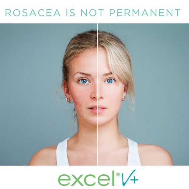 laser treatment logan