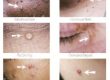 Clinical Skin Clear