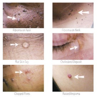 Clinical Skin Clear